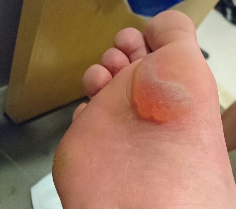 IMG-20170130-WA0012 (2)